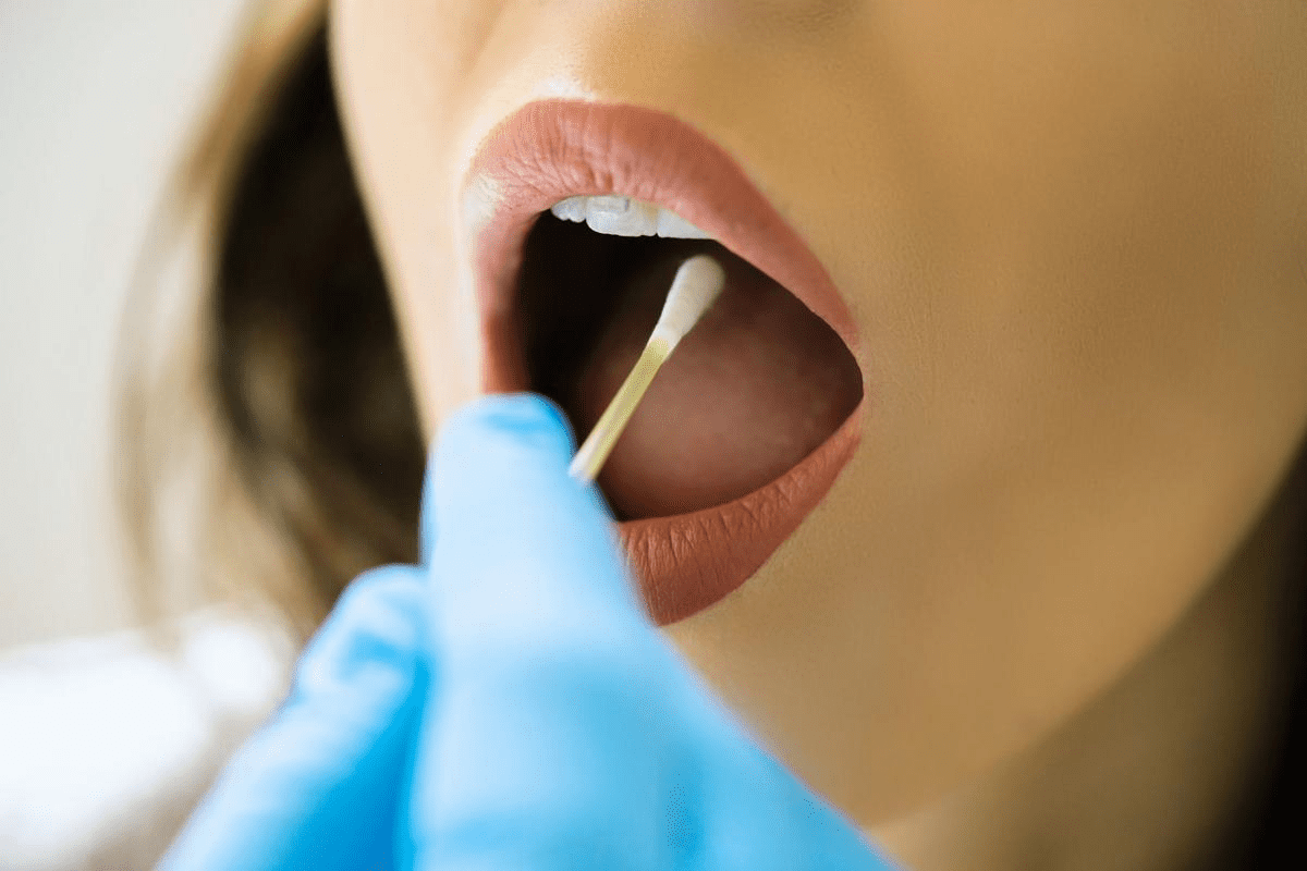 Warning Signs of Gum Cancer: Don't Mistake Them for Gingivitis